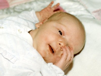 Grace, without the Pox